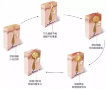 为啥会长痘痘要想战痘成功，必须控制你的强迫